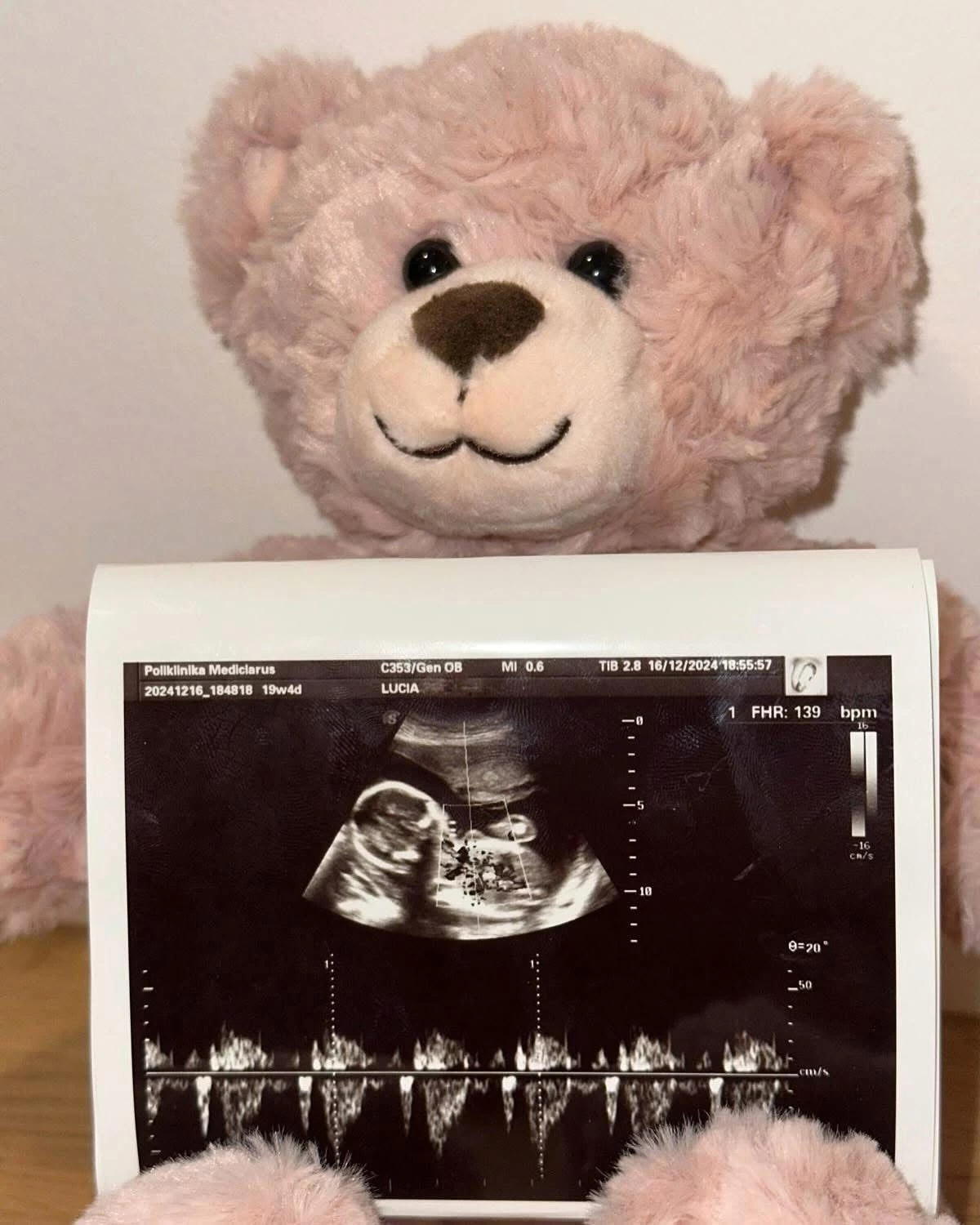 Anomaly Scan - drugi najbitniji ultrazvuk u trudnoći - Poliklinika Mediclarus