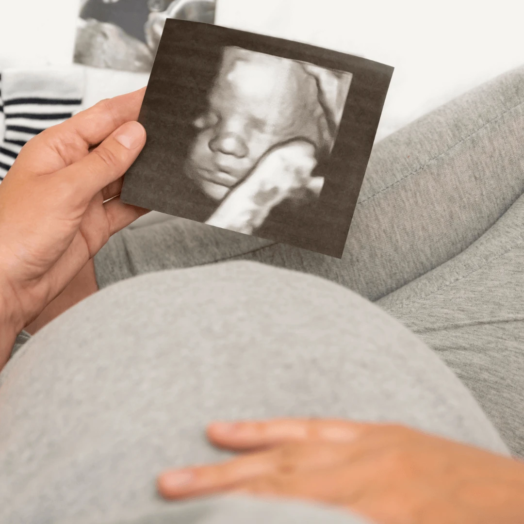 4D ultrazvuk | Poliklinika Mediclarus - Poliklinika Mediclarus